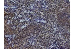 IHC analysis of NRF1 using anti-NRF1 antibody (ABIN6719347). (NRF1 Antikörper  (AA 246-503))