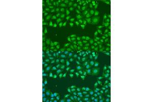 Immunofluorescence analysis of U2OS cells using SSB antibody (ABIN1874948) at dilution of 1:100. (SSB Antikörper)