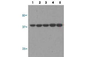 Western blot analysis of Lane 1: A549, Lane 2: H460, Lane 3: H1703, Lane 4: 293, Lane 5: HeLA with JTV1 monoclonal antibody (MAB11292) at 1:1000 dilution. (AIMP2 Antikörper)