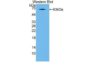 Detection of Recombinant NFIX, Rat using Polyclonal Antibody to Nuclear Factor I/X (NFIX) (NFIX Antikörper  (AA 13-298))