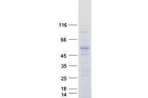 Western Blotting (WB) image for Nuclear Receptor Subfamily 0, Group B, Member 1 (NR0B1) protein (Myc-DYKDDDDK Tag) (ABIN2727529)