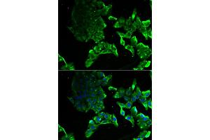 Immunofluorescence analysis of MCF-7 cells using SCYL1 antibody (ABIN5974072). (SCYL1 Antikörper)