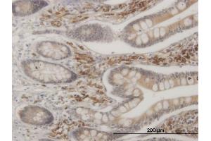 Immunostaining (ISt) image for anti-Mitogen-Activated Protein Kinase-Activated Protein Kinase 2 (MAPKAPK2) (AA 266-352) antibody (ABIN522742)