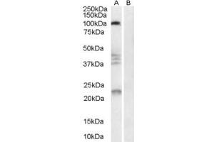 Western Blotting (WB) image for anti-Reticulon 4 (RTN4) (AA 166-179) antibody (ABIN292274)