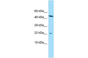 WB Suggested Anti-CGGBP1 Antibody Titration: 1. (CGGBP1 Antikörper  (N-Term))