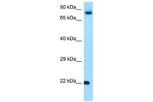 WB Suggested Anti-FGF18 Antibody Titration: 1. (FGF18 Antikörper  (C-Term))