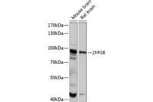 Western blot analysis of extracts of various cell lines, using ZFP28 antibody (ABIN6133031, ABIN6150430, ABIN6150431 and ABIN6215838) at 1:1000 dilution. (ZFP28 Antikörper  (AA 1-349))