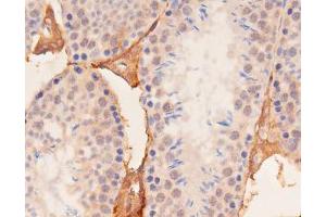 ABIN6267537 at 1/100 staining mouse kidney tissue sections by IHC-P. (YAP1 Antikörper  (pSer127))