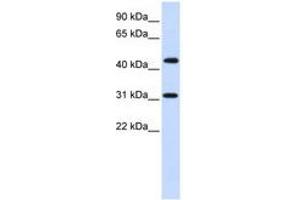 Image no. 1 for anti-Zinc Finger Protein 684 (ZNF684) (AA 72-121) antibody (ABIN6740403) (ZNF684 Antikörper  (AA 72-121))