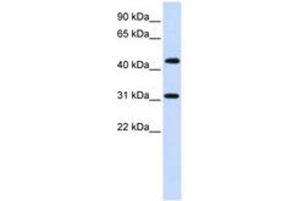 ZNF684 Antikörper  (AA 72-121)