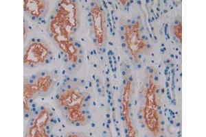 Used in DAB staining on fromalin fixed paraffin- embedded kidney tissue (MAN1A1 Antikörper  (AA 322-653))