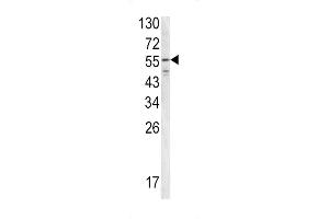 Western blot analysis of FIBB antibody (N-term) (ABIN390413 and ABIN2840802) in T47D cell line lysates (35 μg/lane). (Fibrinogen beta Chain Antikörper  (N-Term))