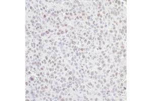 Immunohistochemistry (IHC) image for anti-Guanine Nucleotide Binding Protein-Like 3 (Nucleolar) (GNL3) (C-Term) antibody (ABIN7453884) (Nucleostemin Antikörper  (C-Term))
