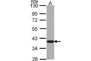WB Image Sample (30 ug of whole cell lysate) A: JurKat 10% SDS PAGE antibody diluted at 1:1000 (LZTFL1 Antikörper)