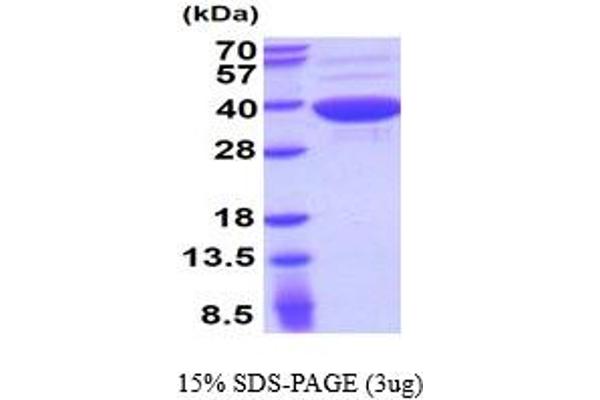 ASPA Protein (AA 1-313)