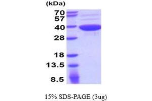 SDS-PAGE (SDS) image for Aspartoacylase (ASPA) (AA 1-313) protein (ABIN5854498)