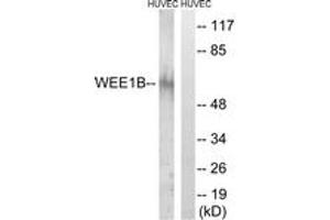 Western blot analysis of extracts from HuvEc cells, using WEE2 Antibody.