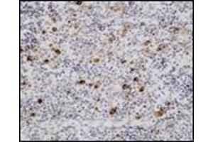 Immunohistochemistry (IHC) image for anti-Epstein-Barr Virus (EBV) (Internal Region) antibody (ABIN870464) (EBV Antikörper  (Internal Region))