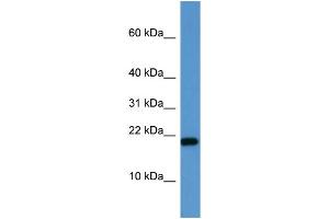WB Suggested Anti-SH2D1A  Antibody Titration: 0. (SH2D1A Antikörper  (C-Term))