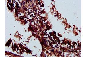 Immunohistochemistry (IHC) image for anti-Leukocyte Immunoglobulin-Like Receptor, Subfamily A (Without TM Domain), Member 3 (LILRA3) (AA 222-313) antibody (ABIN7158256)