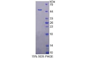 SDS-PAGE analysis of Human TNNC1 Protein. (TNNC1 Protein)