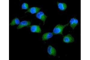 IF analysis of PRKCD using anti-PRKCD antibody (ABIN7601631). (PKC delta Antikörper  (AA 4-676))
