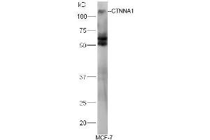 Human MCF-7 lysates probed with Rabbit Anti-Alpha Catenin/CTNNA1 Polyclonal Antibody, Unconjugated (ABIN731813) at 1:300 overnight at 4˚C. (CTNNA1 Antikörper  (AA 801-906))