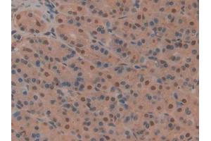 DAB staining on IHC-P; Samples: Rat Stomach Tissue (CD2AP Antikörper  (AA 368-623))