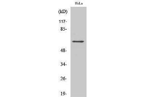 Western Blotting (WB) image for anti-TNF Receptor-Associated Factor 3 (TRAF3) (Internal Region) antibody (ABIN3180368) (TRAF3 Antikörper  (Internal Region))