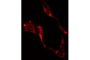 ABIN6274205 staining HuvEc cells by IF/ICC. (ITPKA Antikörper  (N-Term))
