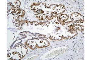 IHC analysis of PHF21A using anti-PHF21A antibody (ABIN6719353).