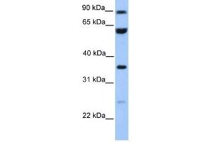 CCDC7 antibody used at 1 ug/ml to detect target protein. (CCDC7 Antikörper  (N-Term))