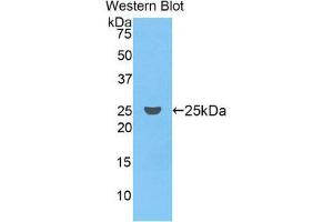 Western Blotting (WB) image for anti-Coagulation Factor IX (F9) (AA 61-263) antibody (ABIN1858770)