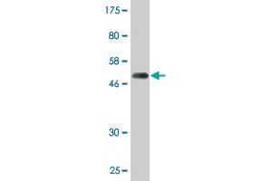 Western Blot detection against Immunogen (50. (PSMD10 Antikörper  (AA 1-226))