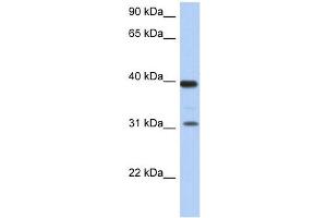 RPSA antibody used at 1 ug/ml to detect target protein. (RPSA/Laminin Receptor Antikörper  (Middle Region))