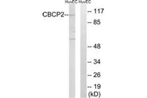 Western blot analysis of extracts from HuvEc cells, using CBCP2 Antibody. (AGBL2 Antikörper  (AA 731-780))