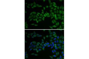 Immunofluorescence analysis of U2OS cells using E2F6 antibody (ABIN1679632, ABIN1679631, ABIN5664137 and ABIN6219769).