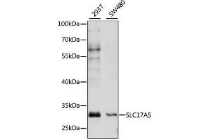 Western blot analysis of extracts of various cell lines, using SLC17 antibody (ABIN7270404) at 1:1000 dilution. (Solute Carrier Family 17 (Acidic Sugar Transporter), Member 5 (SLC17A5) (AA 1-100) Antikörper)