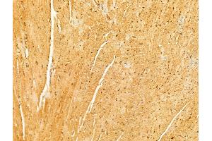 ABIN6265988 and ABIN6273055 at 1/100 staining Mouse heart tissue by IHC-P. (MAVS Antikörper  (C-Term))