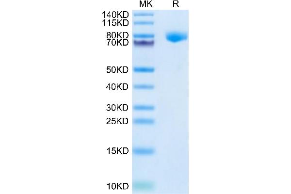 KLKB1 Protein (AA 20-638) (His tag)