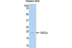Western blot analysis of the recombinant protein. (TNC Antikörper  (AA 356-495))