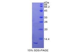 SDS-PAGE analysis of Rat S100A11 Protein. (S100A11 Protein)
