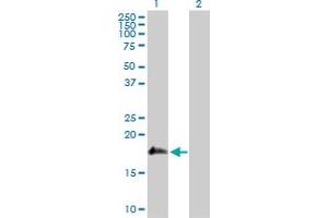 Western Blot analysis of SSH2 expression in transfected 293T cell line by SSH2 MaxPab polyclonal antibody. (SSH2 Antikörper  (AA 1-178))