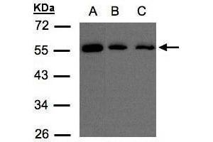 WB Image Sample(30 μg of whole cell lysate) A:H1299 B:Hep G2, C:MOLT4 , 10% SDS PAGE antibody diluted at 1:500 (OSBPL2 Antikörper  (C-Term))