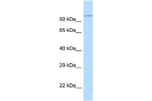 WB Suggested Anti-Adam29 Antibody   Titration: 1. (ADAM29 Antikörper  (N-Term))