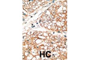 Immunohistochemistry (IHC) image for anti-BCL2-Related Ovarian Killer (BOK) (BH3 Domain) antibody (ABIN2997148)