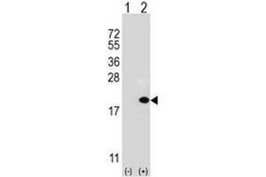 Western blot analysis of UBE2V1 antibody and 293 cell lysate (2 ug/lane) either nontransfected (Lane 1) or transiently transfected (2) with the UBE2V1 gene. (UBE2V1 Antikörper  (AA 113-145))