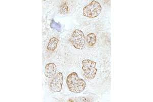 Immunohistochemistry (IHC) image for anti-SSB1 (AA 161-211) antibody (ABIN7448816) (SSB1 (AA 161-211) Antikörper)