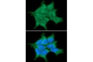 ICC/IF analysis of PPM1G in 293T cells line, stained with DAPI (Blue) for nucleus staining and monoclonal anti-human PPM1G antibody (1:100) with goat anti-mouse IgG-Alexa fluor 488 conjugate (Green) (PPM1G Antikörper)