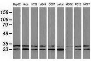 Western blot analysis of extracts (35 µg) from 9 different cell lines by using anti-CLPP monoclonal antibody. (CLPP Antikörper)